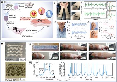 Resorbable conductive materials for optimally interfacing medical devices with the living